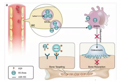 我国科学家发现血管内皮细胞来源外泌体在骨代谢调控中发挥重要作用[图]