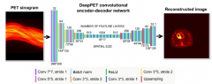 科学家们使用人工智能技术改进传统PET成像方法[图]